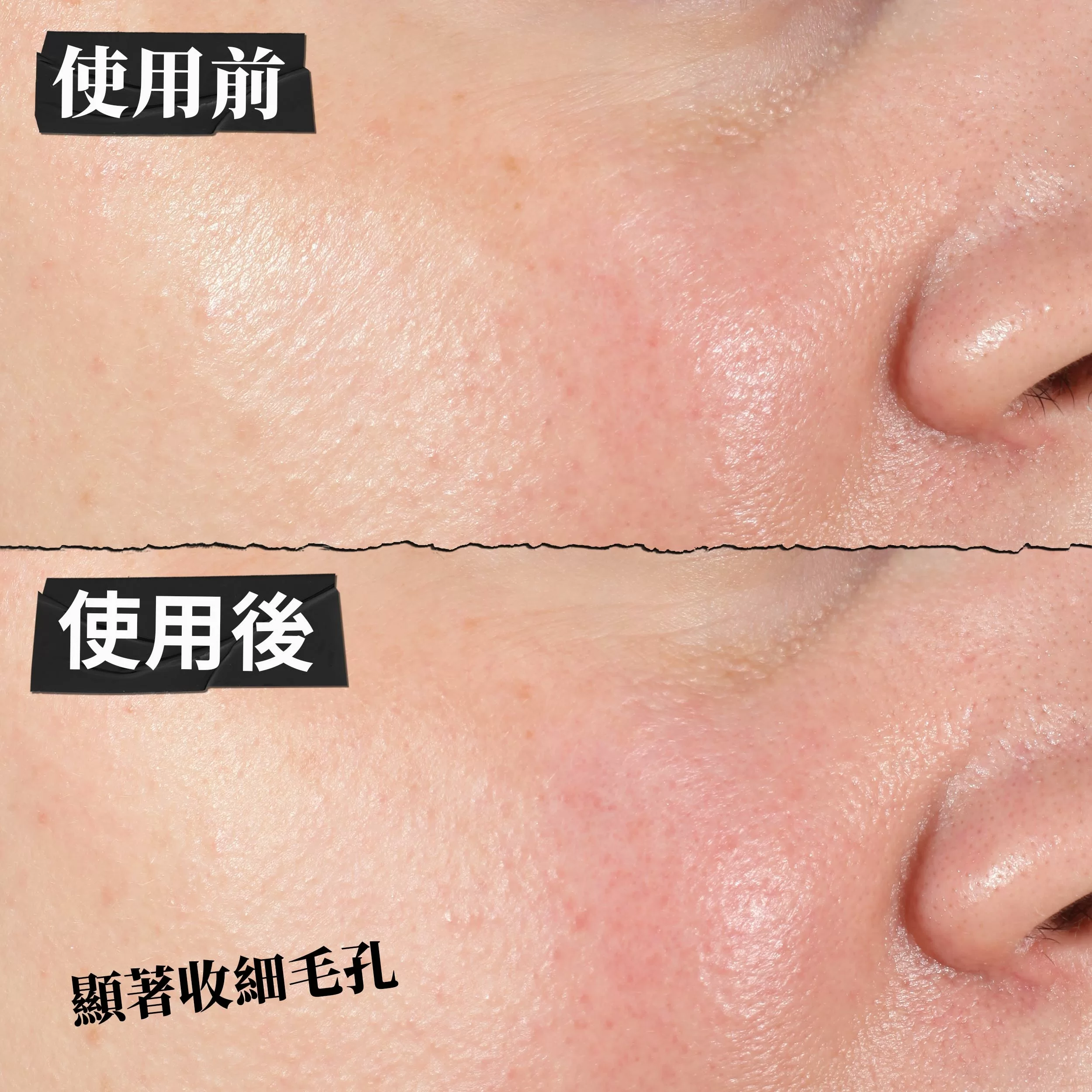 醫學高效保濕精華